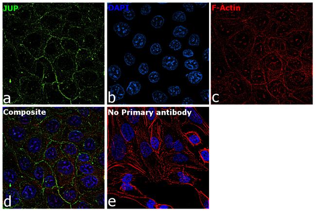 gamma Catenin Antibody in Immunocytochemistry (ICC/IF)