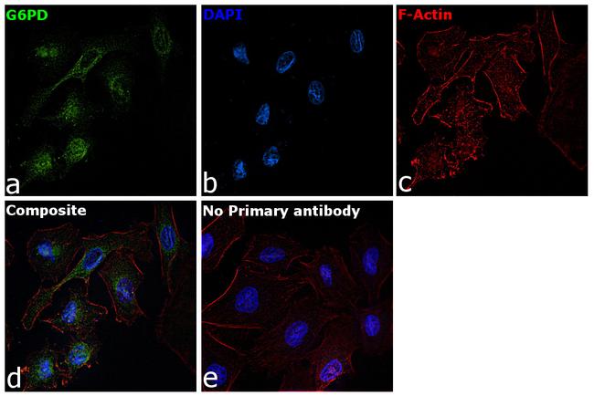 G6PD Antibody in Immunocytochemistry (ICC/IF)