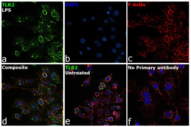 TLR2 Antibody in Immunocytochemistry (ICC/IF)