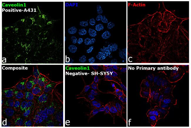 Caveolin 1 Antibody in Immunocytochemistry (ICC/IF)