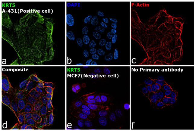 Cytokeratin 5 Antibody in Immunocytochemistry (ICC/IF)