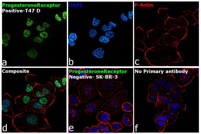 Progesterone Receptor Antibody in Immunocytochemistry (ICC/IF)