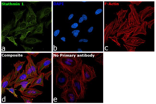 Stathmin 1 Antibody in Immunocytochemistry (ICC/IF)