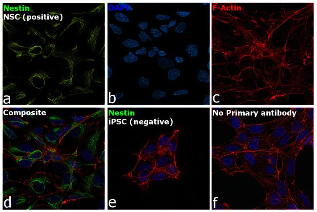 Nestin Antibody in Immunocytochemistry (ICC/IF)