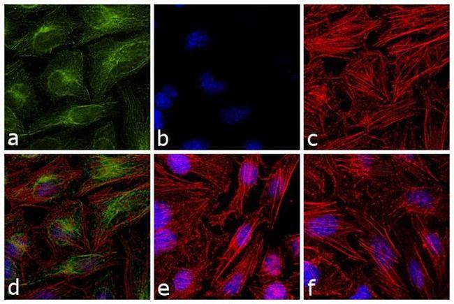 Mouse IgG1 (Heavy chain) Secondary Antibody in Immunocytochemistry (ICC/IF)