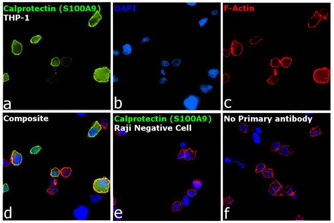 Calprotectin Antibody in Immunocytochemistry (ICC/IF)