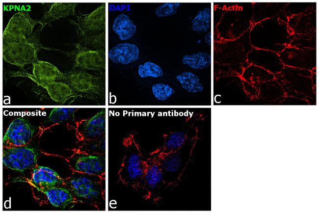 KPNA2 Antibody in Immunocytochemistry (ICC/IF)