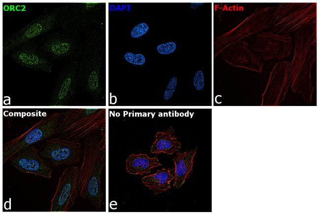 ORC2 Antibody in Immunocytochemistry (ICC/IF)