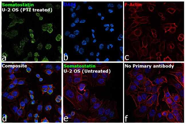 Somatostatin Antibody in Immunocytochemistry (ICC/IF)