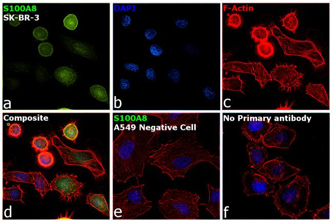 S100A8 Antibody in Immunocytochemistry (ICC/IF)