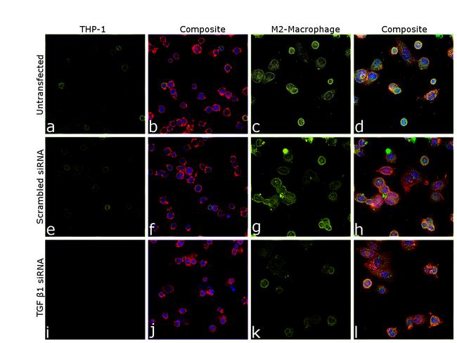 TGF beta-1 Antibody in Immunocytochemistry (ICC/IF)