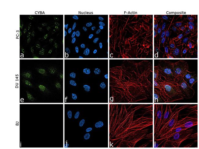 CYBA Antibody in Immunocytochemistry (ICC/IF)