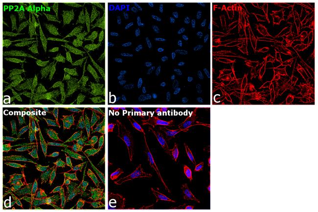 PP2A alpha Antibody in Immunocytochemistry (ICC/IF)