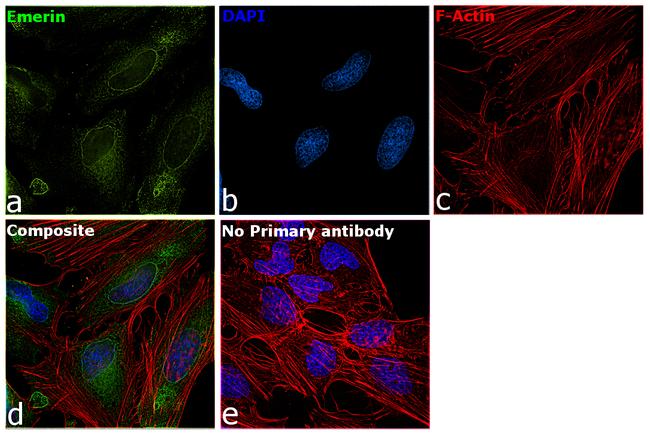 Emerin Antibody in Immunocytochemistry (ICC/IF)