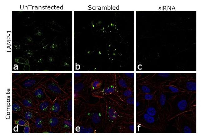 LAMP1 Antibody in Immunocytochemistry (ICC/IF)