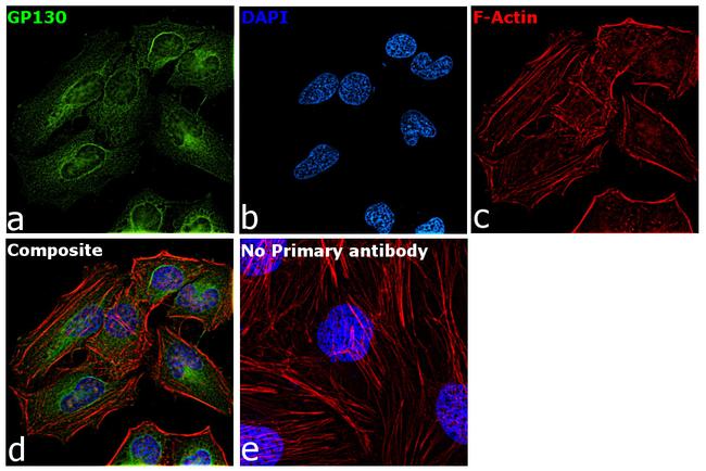 GP130 Antibody in Immunocytochemistry (ICC/IF)