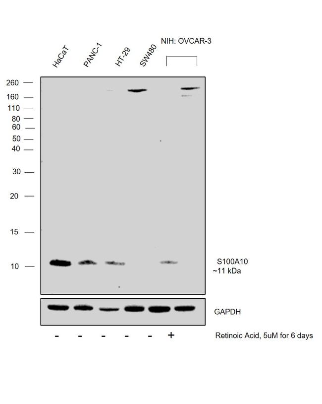 S100A10 Antibody in Western Blot (WB)