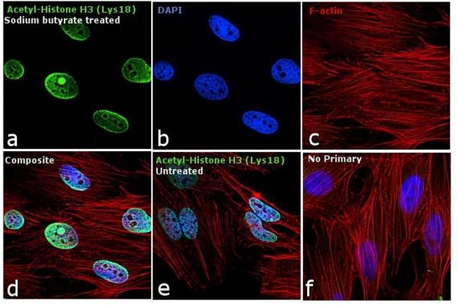 H3K18ac Antibody in Immunocytochemistry (ICC/IF)