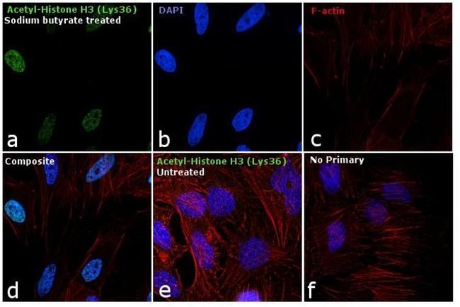 H3K36ac Antibody in Immunocytochemistry (ICC/IF)