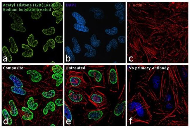 H2BK20ac Antibody in Immunocytochemistry (ICC/IF)