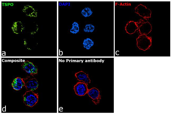 TSPO Antibody in Immunocytochemistry (ICC/IF)