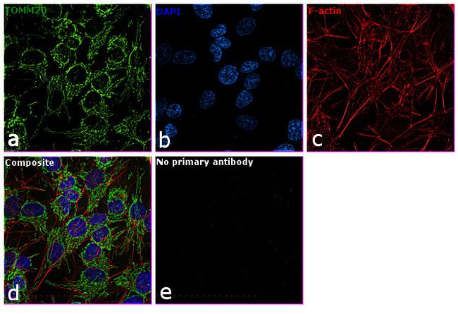 TOMM20 Antibody in Immunocytochemistry (ICC/IF)