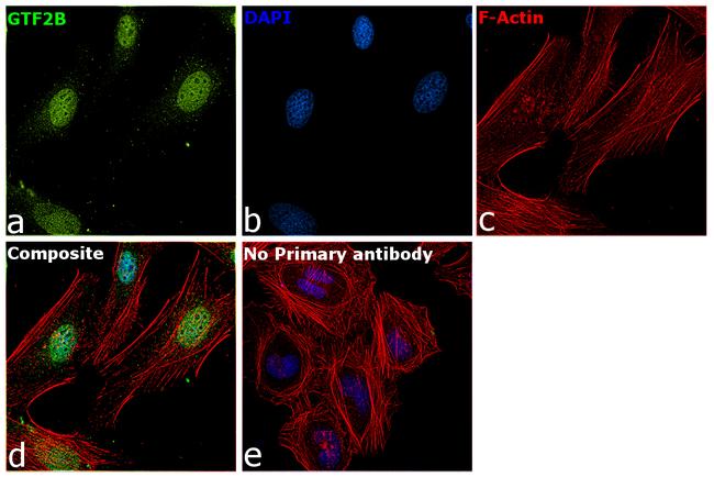 GTF2B Antibody in Immunocytochemistry (ICC/IF)