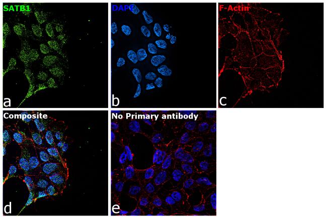 SATB1 Antibody in Immunocytochemistry (ICC/IF)