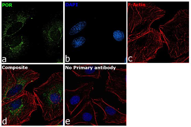 Cytochrome P450 Reductase Antibody in Immunocytochemistry (ICC/IF)