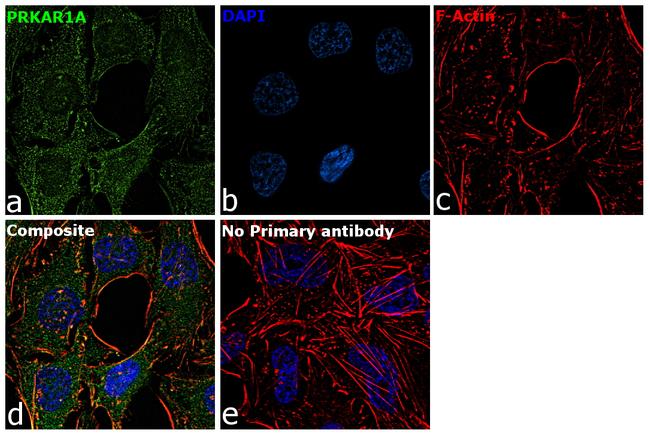 PRKAR1A Antibody in Immunocytochemistry (ICC/IF)