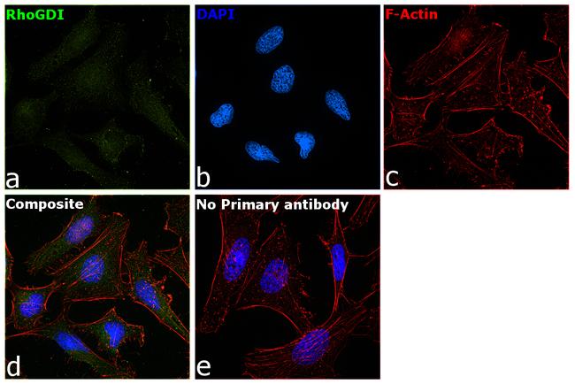 RhoGDI Antibody in Immunocytochemistry (ICC/IF)