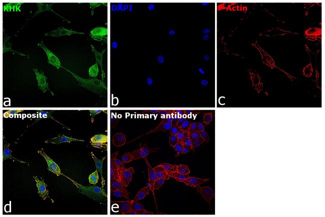 KHK Antibody in Immunocytochemistry (ICC/IF)