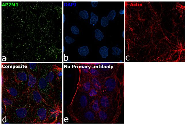 AP2M1 Antibody in Immunocytochemistry (ICC/IF)