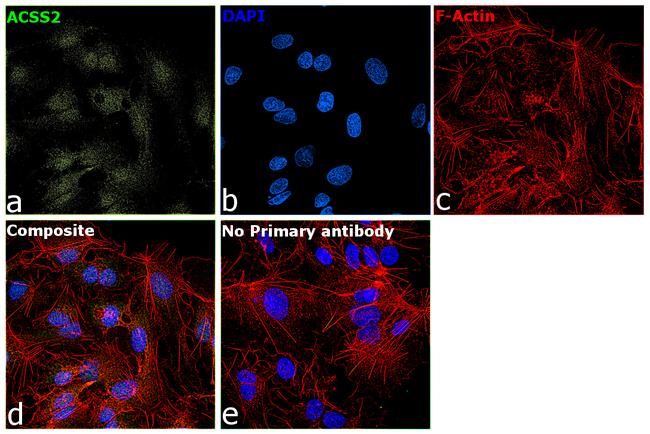 ACSS2 Antibody in Immunocytochemistry (ICC/IF)