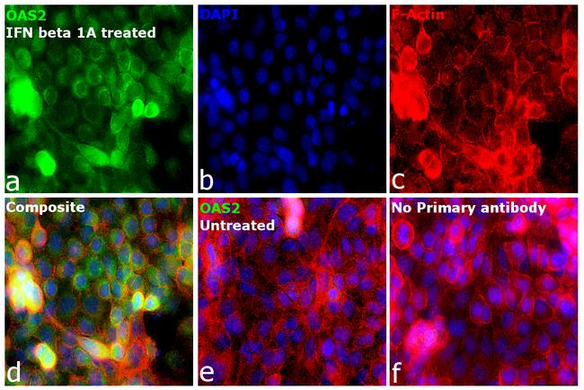 OAS2 Antibody in Immunocytochemistry (ICC/IF)