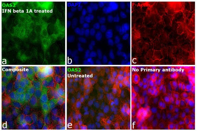 OAS2 Antibody in Immunocytochemistry (ICC/IF)