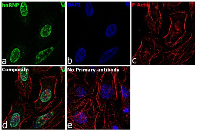 hnRNP L Antibody in Immunocytochemistry (ICC/IF)