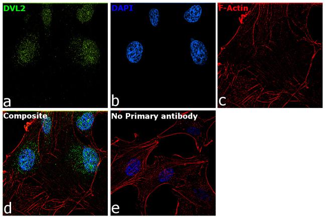 DVL2 Antibody in Immunocytochemistry (ICC/IF)