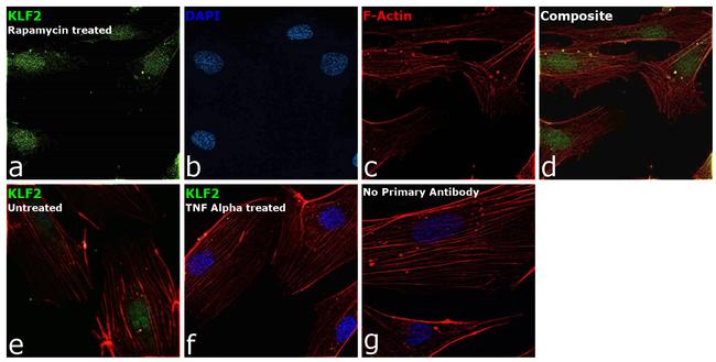 KLF2 Antibody in Immunocytochemistry (ICC/IF)