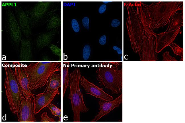 APPL1 Antibody in Immunocytochemistry (ICC/IF)