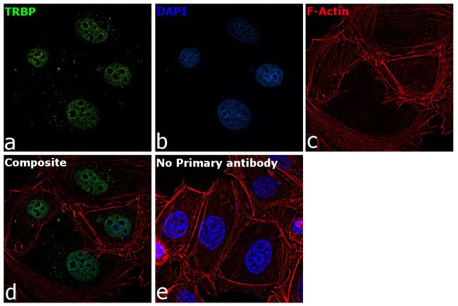 TRBP Antibody in Immunocytochemistry (ICC/IF)