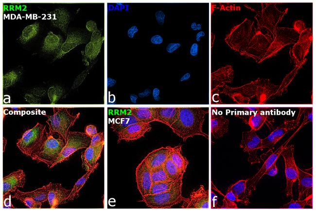 RRM2 Antibody in Immunocytochemistry (ICC/IF)