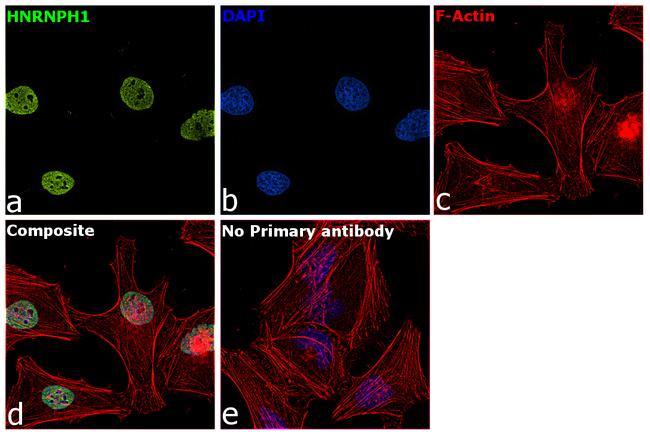 hnRNP H1 Antibody in Immunocytochemistry (ICC/IF)