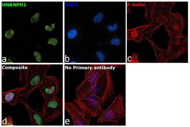 hnRNP H1 Antibody in Immunocytochemistry (ICC/IF)