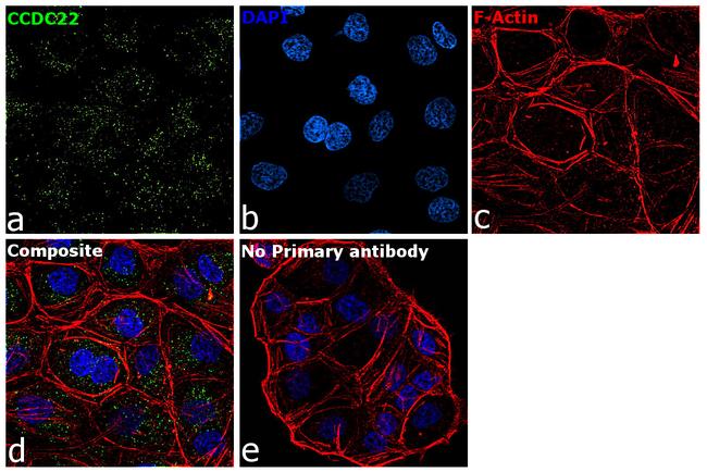 CCDC22 Antibody in Immunocytochemistry (ICC/IF)