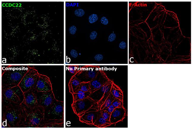 CCDC22 Antibody in Immunocytochemistry (ICC/IF)