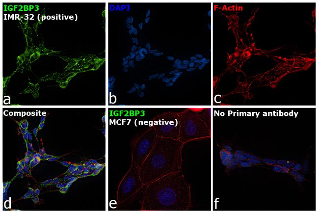 IGF2BP3 Antibody in Immunocytochemistry (ICC/IF)