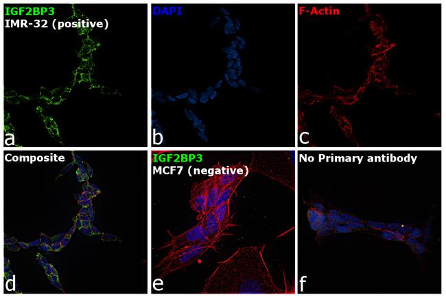 IGF2BP3 Antibody in Immunocytochemistry (ICC/IF)