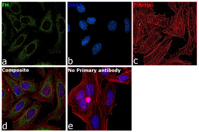 Fumarase Antibody in Immunocytochemistry (ICC/IF)