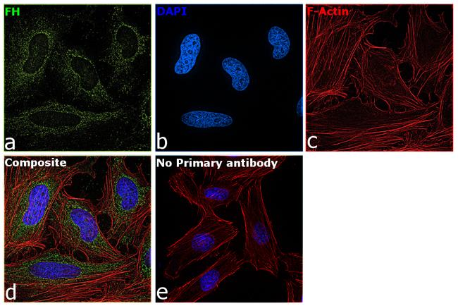 Fumarase Antibody in Immunocytochemistry (ICC/IF)